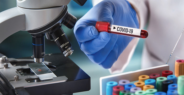 microbiologist with a tube of blood analyzed under a microscope